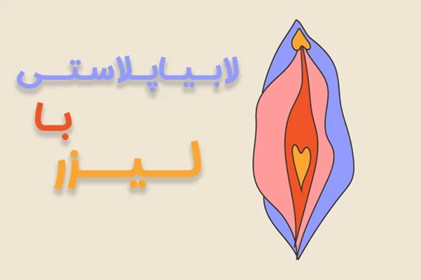 اپل