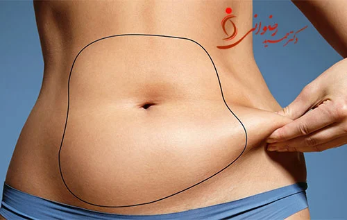 Side effects of removing belly fat