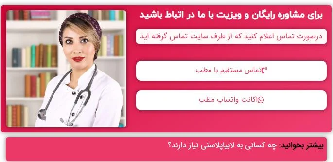 اپل