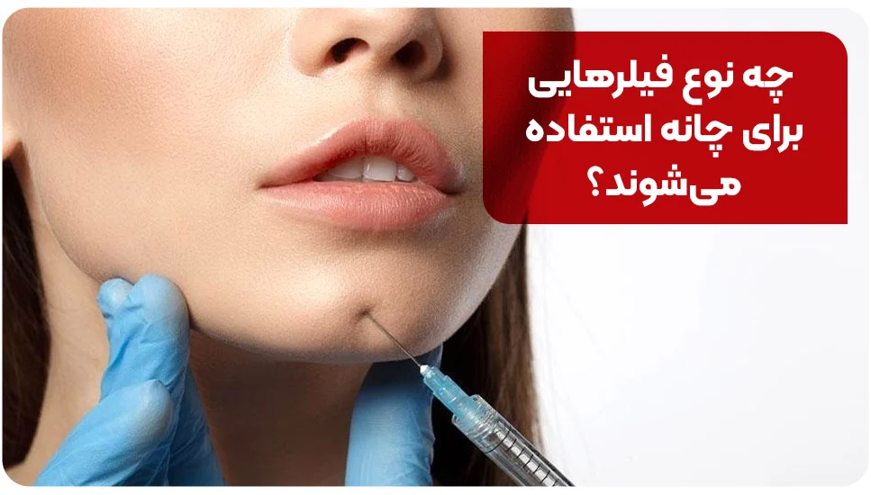 کسب و کار ایرانی