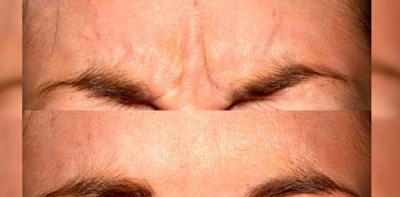 پاکسازی پوست