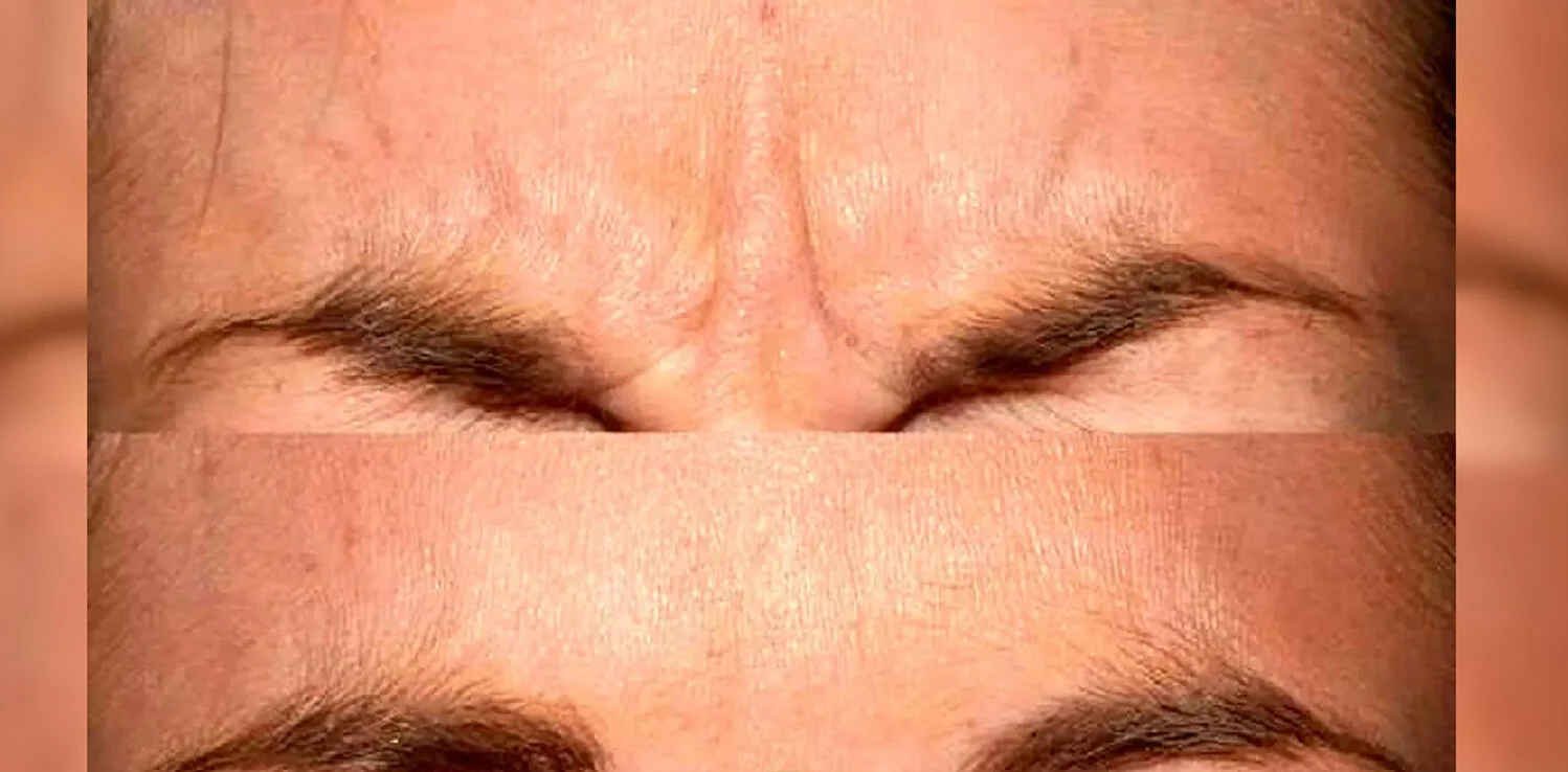 آبرسان |پاکسازی