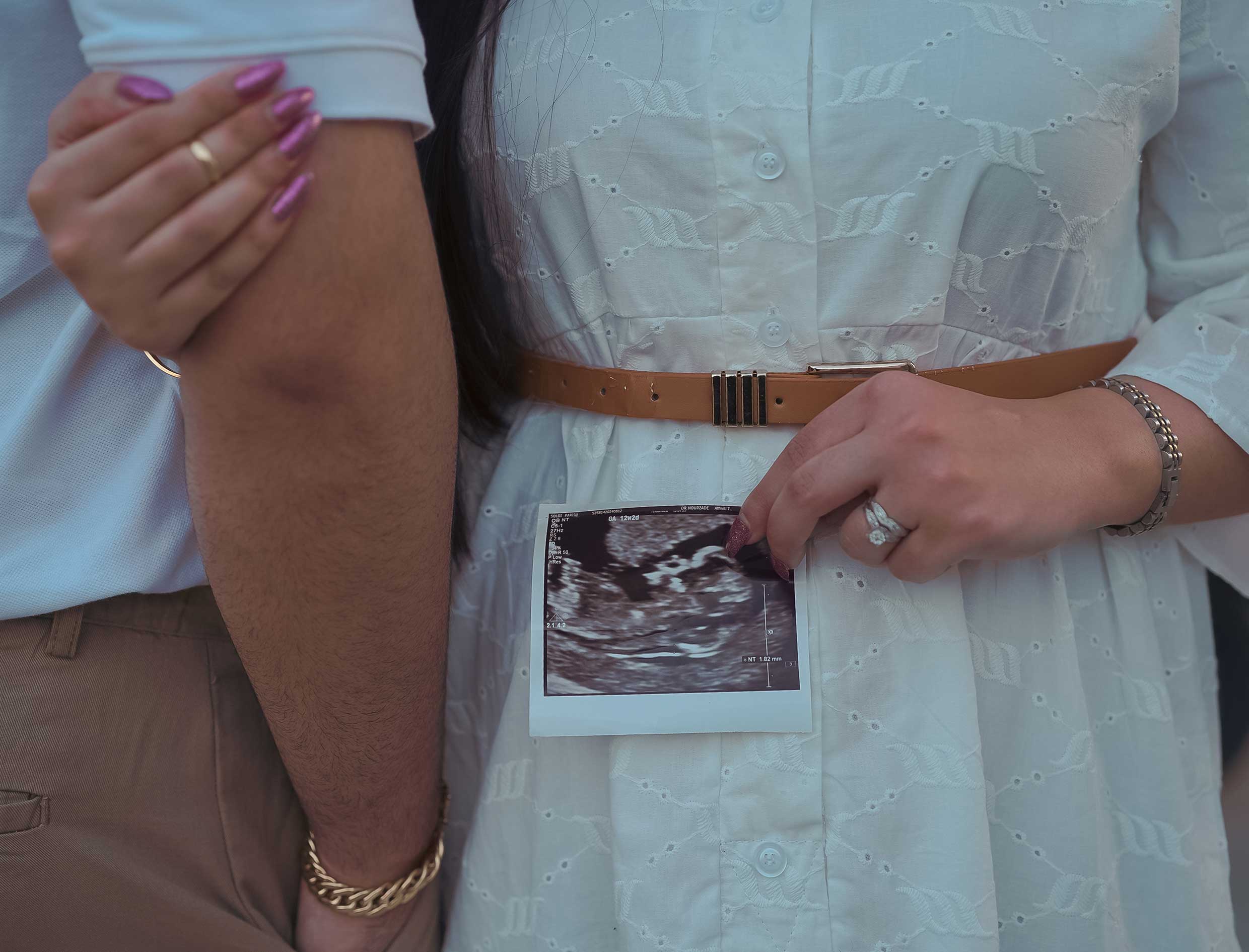 بارداری |طبیعت